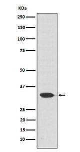 Anti-Otx2 Rabbit Monoclonal Antibody Boster Bio