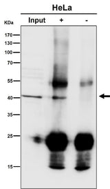 Anti-ACAT1 Rabbit Monoclonal Antibody Boster Bio