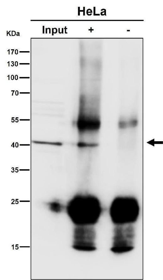 Anti-ACAT1 Rabbit Monoclonal Antibody Boster Bio