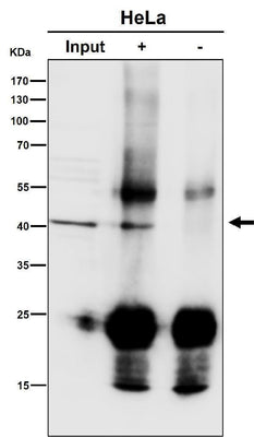 Anti-ACAT1 Rabbit Monoclonal Antibody Boster Bio