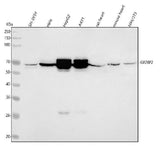 Anti-IMP2 Rabbit Monoclonal Antibody Boster Bio