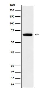 Anti-IGF2BP2 Rabbit Monoclonal Antibody Boster Bio