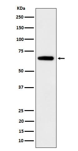 Anti-IGF2BP2 Rabbit Monoclonal Antibody Boster Bio