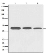 Anti-Actin ACTA1 Rabbit Monoclonal Antibody Boster Bio
