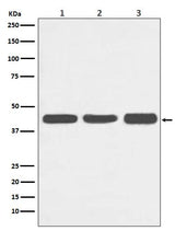 Anti-Actin ACTA1 Rabbit Monoclonal Antibody Boster Bio