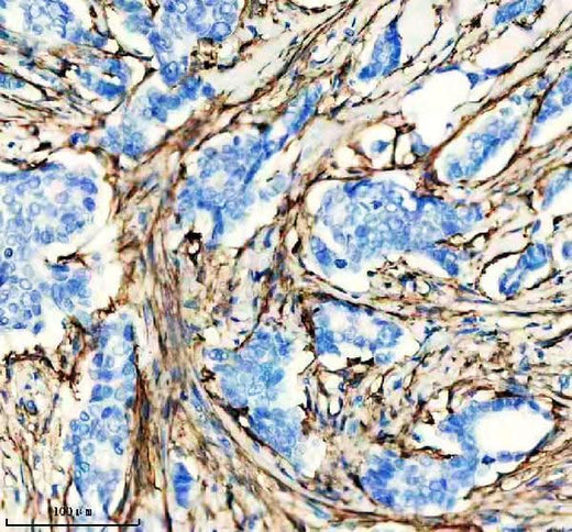 Anti-Actin (Alpha-Actin) ACTA1 Rabbit Monoclonal Antibody Boster Bio