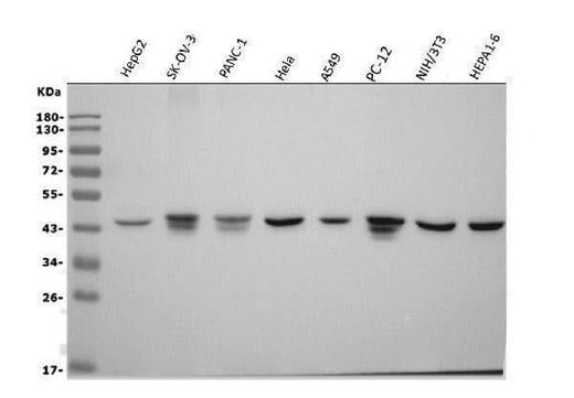 Anti-Actin/ACTA1 Antibody Picoband® (monoclonal, 3H5 Boster Bio