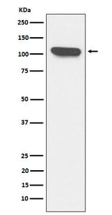 Anti-ERAP1 Rabbit Monoclonal Antibody Boster Bio