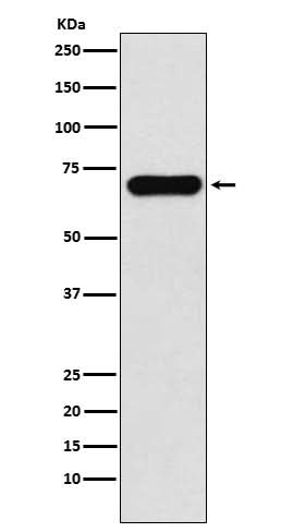 Anti-PCK1 Rabbit Monoclonal Antibody Boster Bio