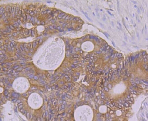 Anti-PON2 Rabbit Monoclonal Antibody Boster Bio