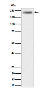 Anti-DENN Rabbit Monoclonal Antibody Boster Bio