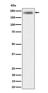 Anti-DENN Rabbit Monoclonal Antibody Boster Bio