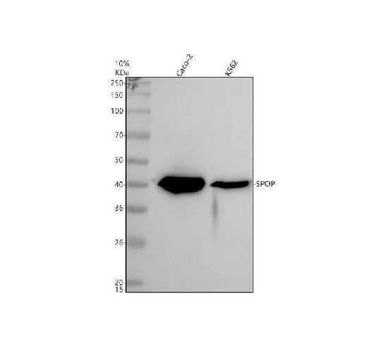 Anti-SPOP Rabbit Monoclonal Antibody Boster Bio