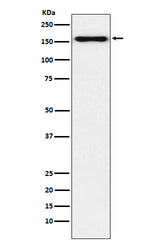 Anti-Desmoglein 2 Monoclonal Antibody Boster Bio