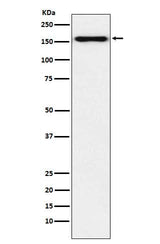 Anti-Desmoglein 2 Monoclonal Antibody Boster Bio
