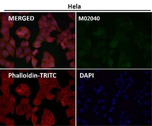 Anti-Cyclin B2 CCNB2 Rabbit Monoclonal Antibody Boster Bio