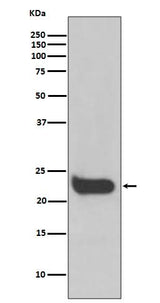 Anti-Interferon beta Rabbit Monoclonal Antibody Boster Bio