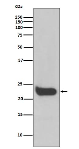 Anti-Interferon beta Rabbit Monoclonal Antibody Boster Bio