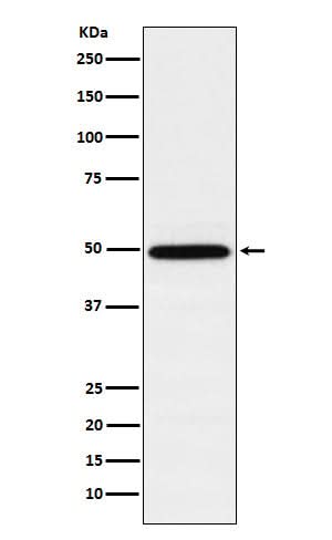 Anti-TIP49A Rabbit Monoclonal Antibody Boster Bio