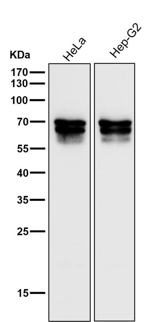 Anti-PICALM Rabbit Monoclonal Antibody Boster Bio