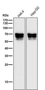 Anti-PICALM Rabbit Monoclonal Antibody Boster Bio