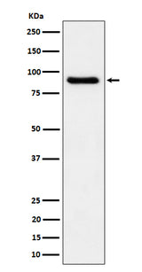 Anti-C1s Rabbit Monoclonal Antibody Boster Bio