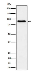 Anti-C1s Rabbit Monoclonal Antibody Boster Bio