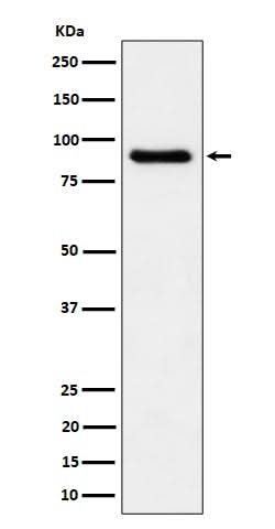 Anti-C1s Rabbit Monoclonal Antibody Boster Bio