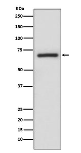 Anti-A-RAF Rabbit Monoclonal Antibody Boster Bio