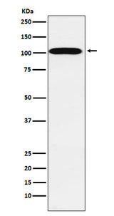 Anti-ATP1A2 Rabbit Monoclonal Antibody Boster Bio