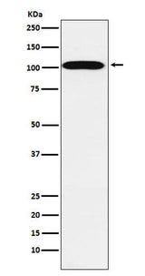 Anti-ATP1A2 Rabbit Monoclonal Antibody Boster Bio