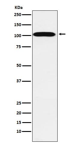 Anti-ATP1A2 Rabbit Monoclonal Antibody Boster Bio