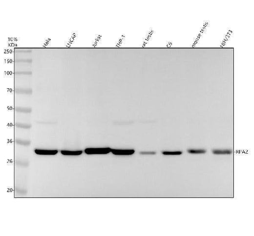 Anti-RFA2 Rabbit Monoclonal Antibody Boster Bio