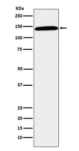 Anti-CD42b Rabbit Monoclonal Antibody Boster Bio