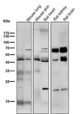 Anti-SMYD3 Monoclonal Antibody Boster Bio