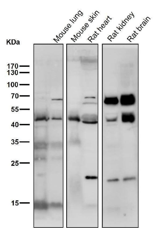 Anti-SMYD3 Monoclonal Antibody Boster Bio