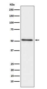 Anti-Prostatic Acid Phosphatase ACPP Monoclonal Antibody Boster Bio