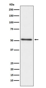 Anti-Prostatic Acid Phosphatase ACPP Monoclonal Antibody Boster Bio