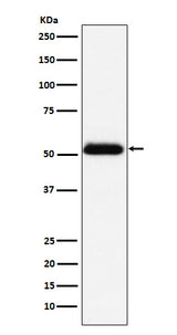 Anti-Prostatic Acid Phosphatase Rabbit Monoclonal Antibody Boster Bio