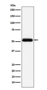 Anti-Prostatic Acid Phosphatase Rabbit Monoclonal Antibody Boster Bio