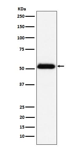 Anti-Prostatic Acid Phosphatase Rabbit Monoclonal Antibody Boster Bio
