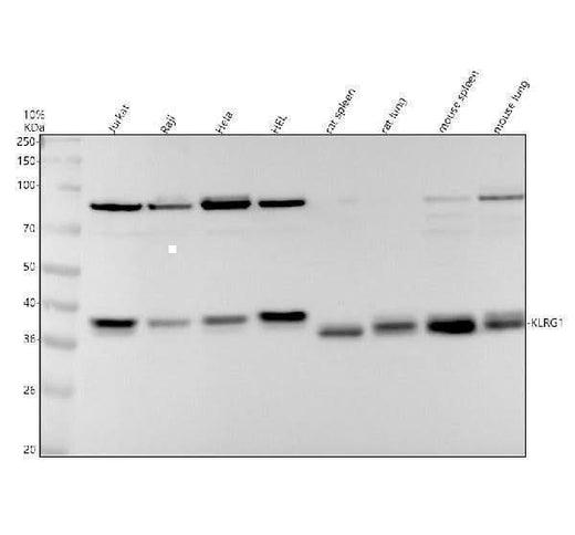 Anti-KLRG1 Rabbit Monoclonal Antibody Boster Bio