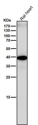Anti-Sprouty 2 SPRY2 Monoclonal Antibody Boster Bio