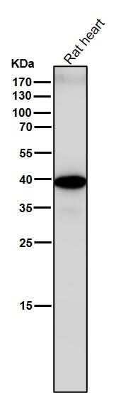 Anti-Sprouty 2 SPRY2 Monoclonal Antibody Boster Bio