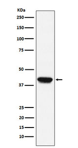 Anti-Biglycan Monoclonal Antibody Boster Bio