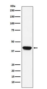 Anti-Biglycan Monoclonal Antibody Boster Bio