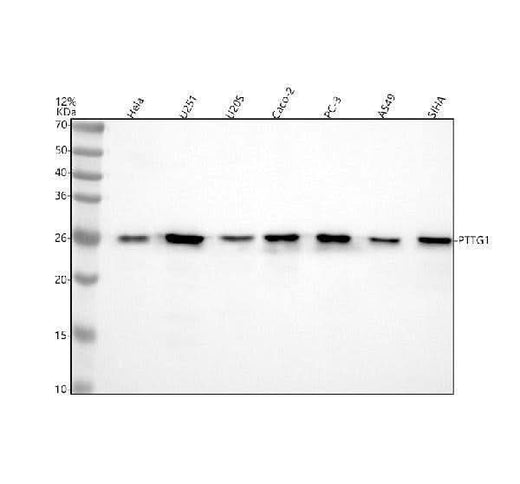 Anti-Securin Monoclonal Antibody Boster Bio