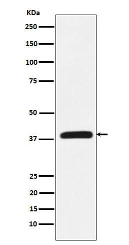 Anti-CRKL Rabbit Monoclonal Antibody Boster Bio