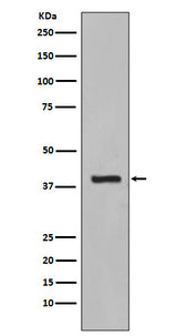Anti-Cytokeratin 19 KRT19 Rabbit Monoclonal Antibody Boster Bio