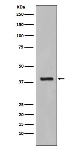 Anti-Cytokeratin 19 KRT19 Rabbit Monoclonal Antibody Boster Bio